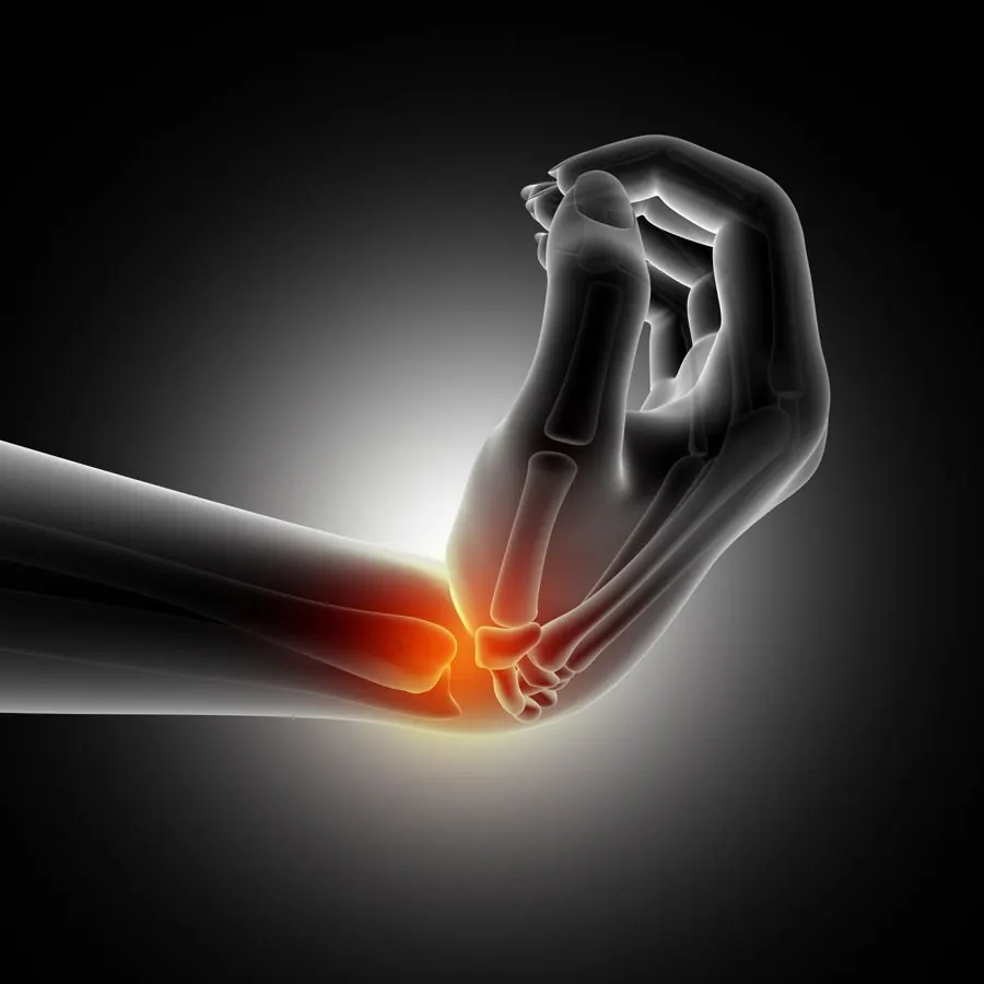 Illustration: elbow joint inflammation