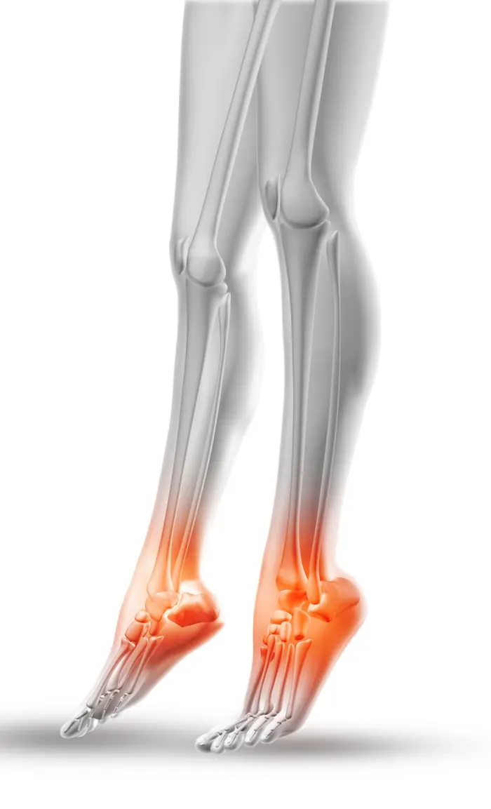 Illustration: leg and ankle pain