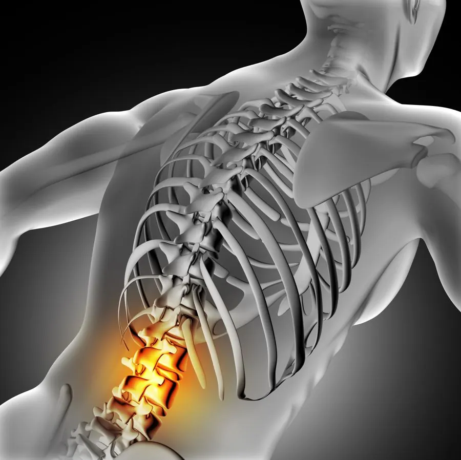 Illustration: lumbar spine and disc